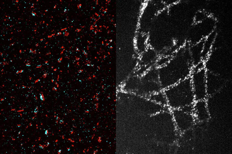 A new method makes high-resolution imaging more accessible | MIT News