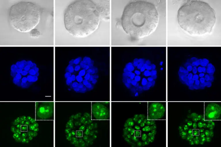 Cancer biologists discover a new mechanism for an old drug | MIT News